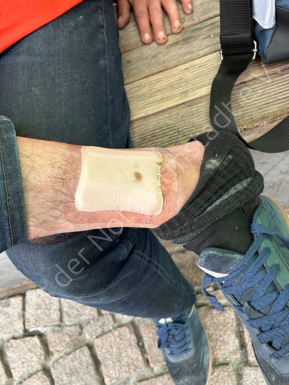 Wundversorgung auf der Straße